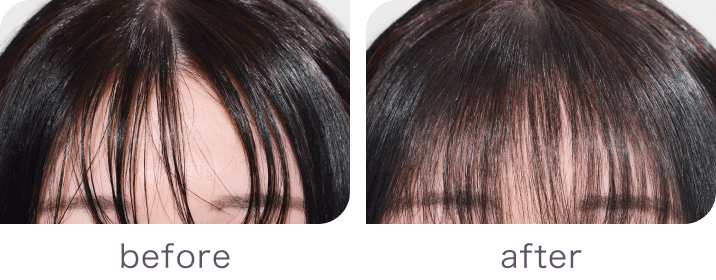 Before After